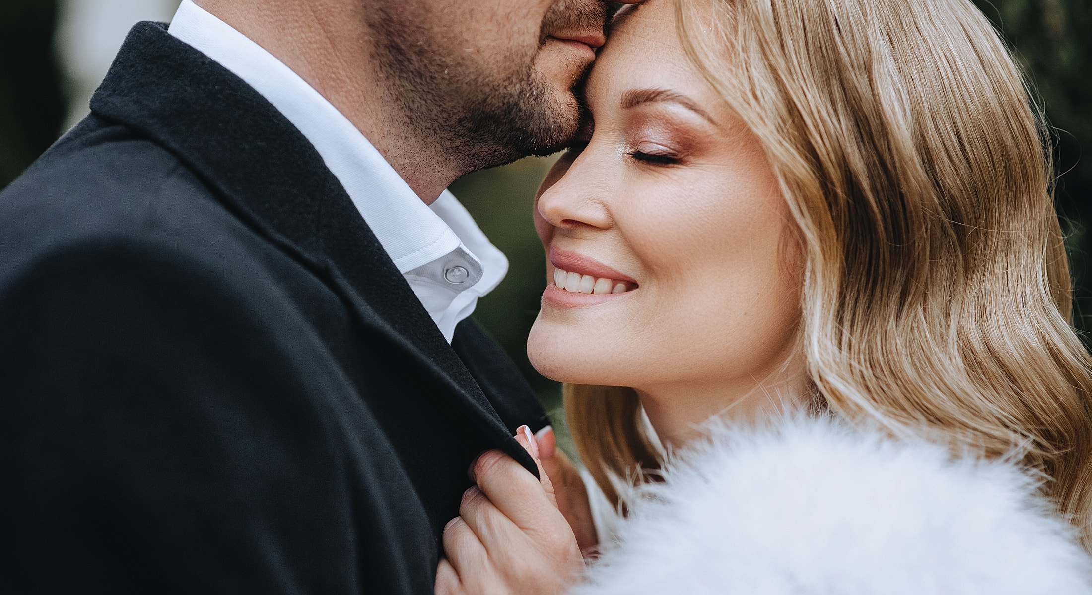 Dental Veneers in Chicago